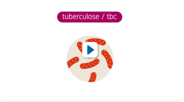 Video wat is tuberculose (RIVM)