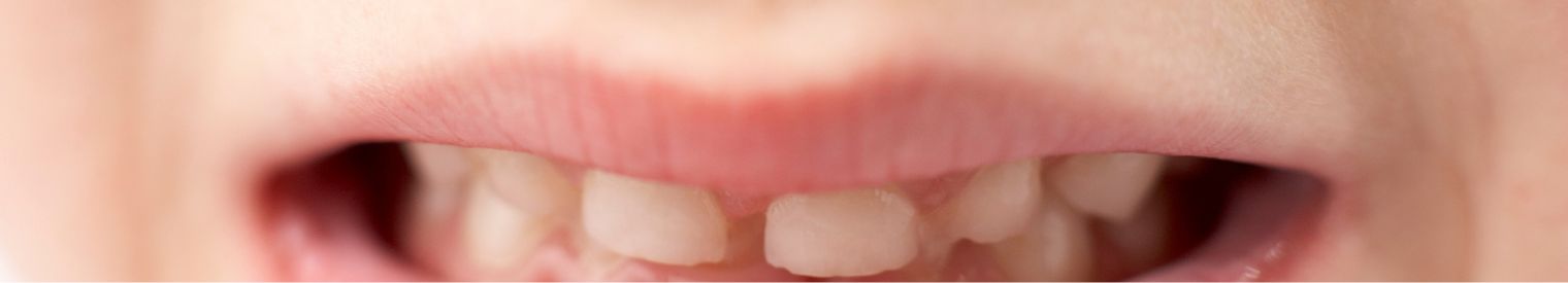 Tandzorg header
