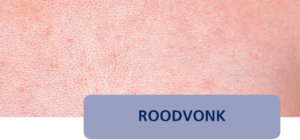 Roodvonk