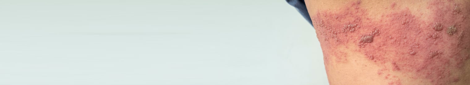 gordelroos website