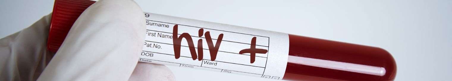 HIV